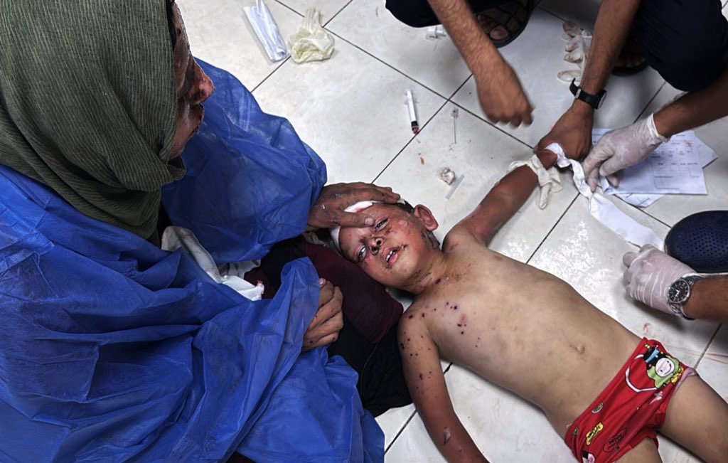 🚨Two people including a CHILD and several others WOUNDED in Israeli bombing of tents in Al Mawasi area, west Khan Younis!