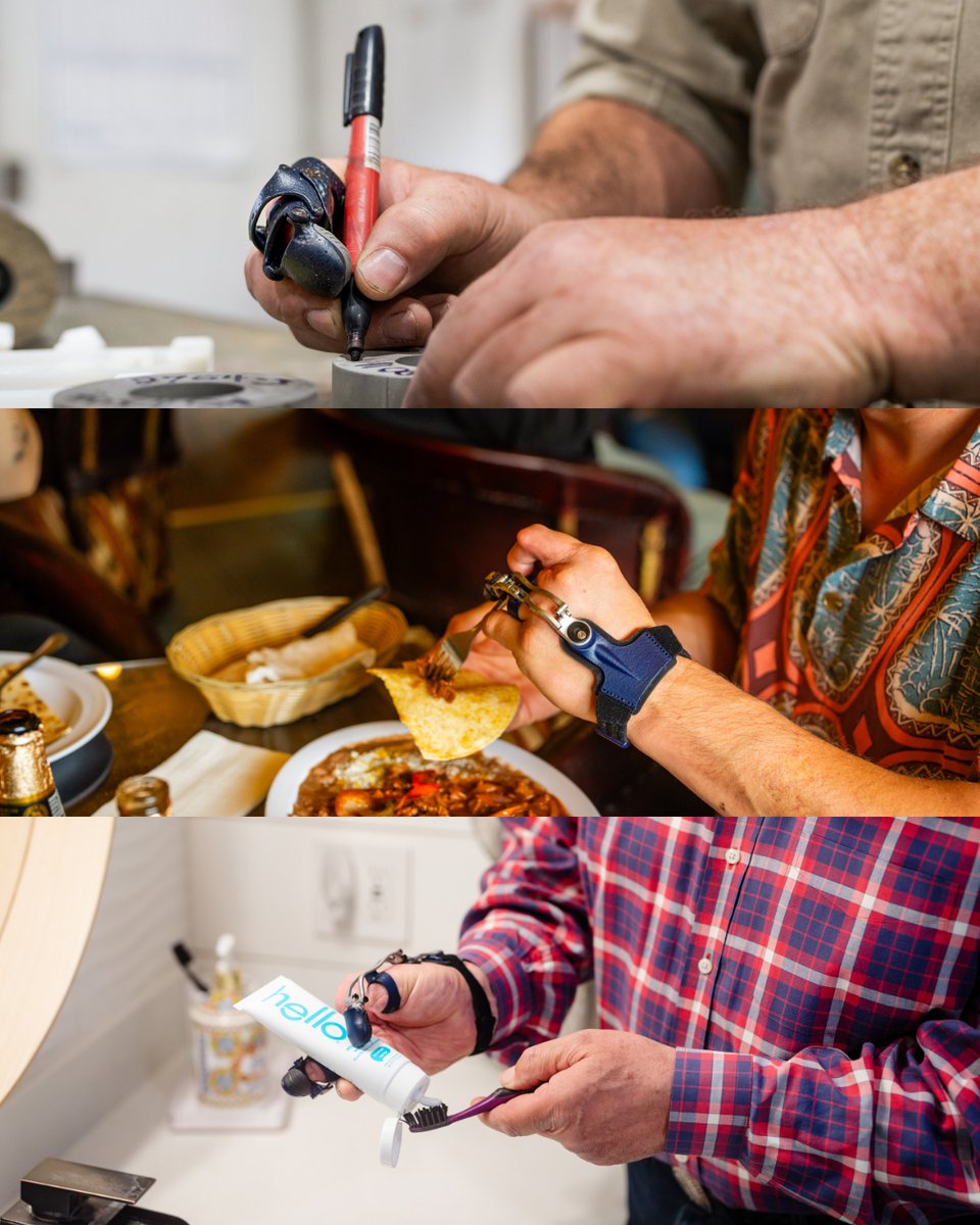 NPDevices's tweet image. Our body-driven prostheses—PIPDriver, MCPDriver, and ThumbDriver—utilize the end-user’s intact joints to provide grip strength and dexterity. Learn more at npdevices.com!

#NakedProsthetics #ItsAllAboutFunction