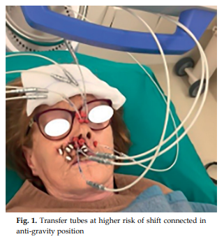 This study aimed to investigate quality control (QC) strategies to enhance treatment delivery in interventional radiotherapy (IRT) for head and neck (H&amp;N) cancers
termedia.pl/Quality-contro…