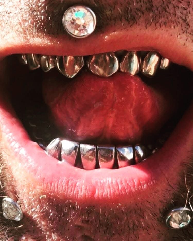 Time for some dental work….keep the front fangs or change it up?