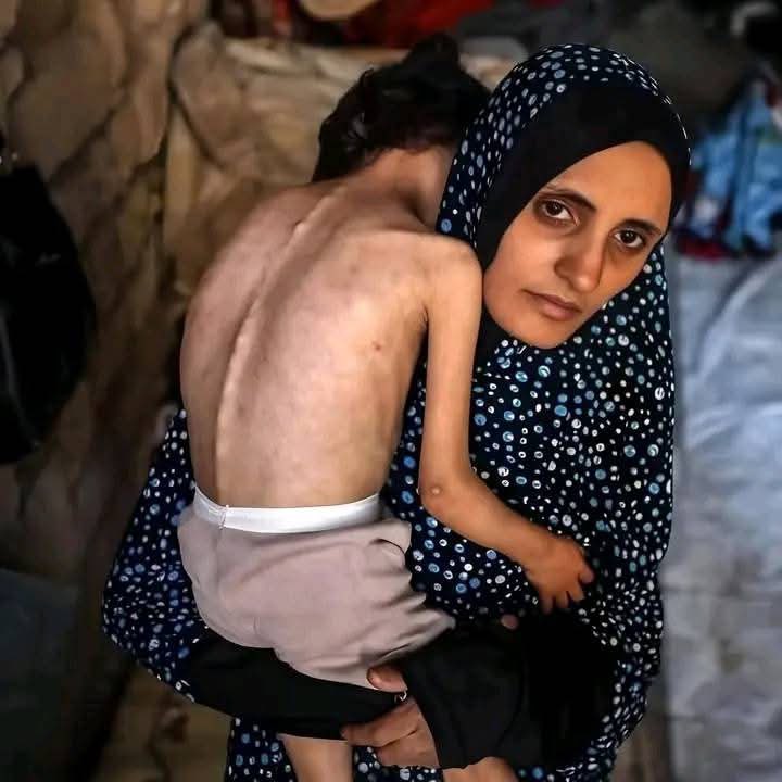 yousef_ki1's tweet photo. Look at this little angel, He is starving 💔
If you see this pic, reply with 🇵🇸 pray for him 💔 https://t.co/Dor4o3XPo6
