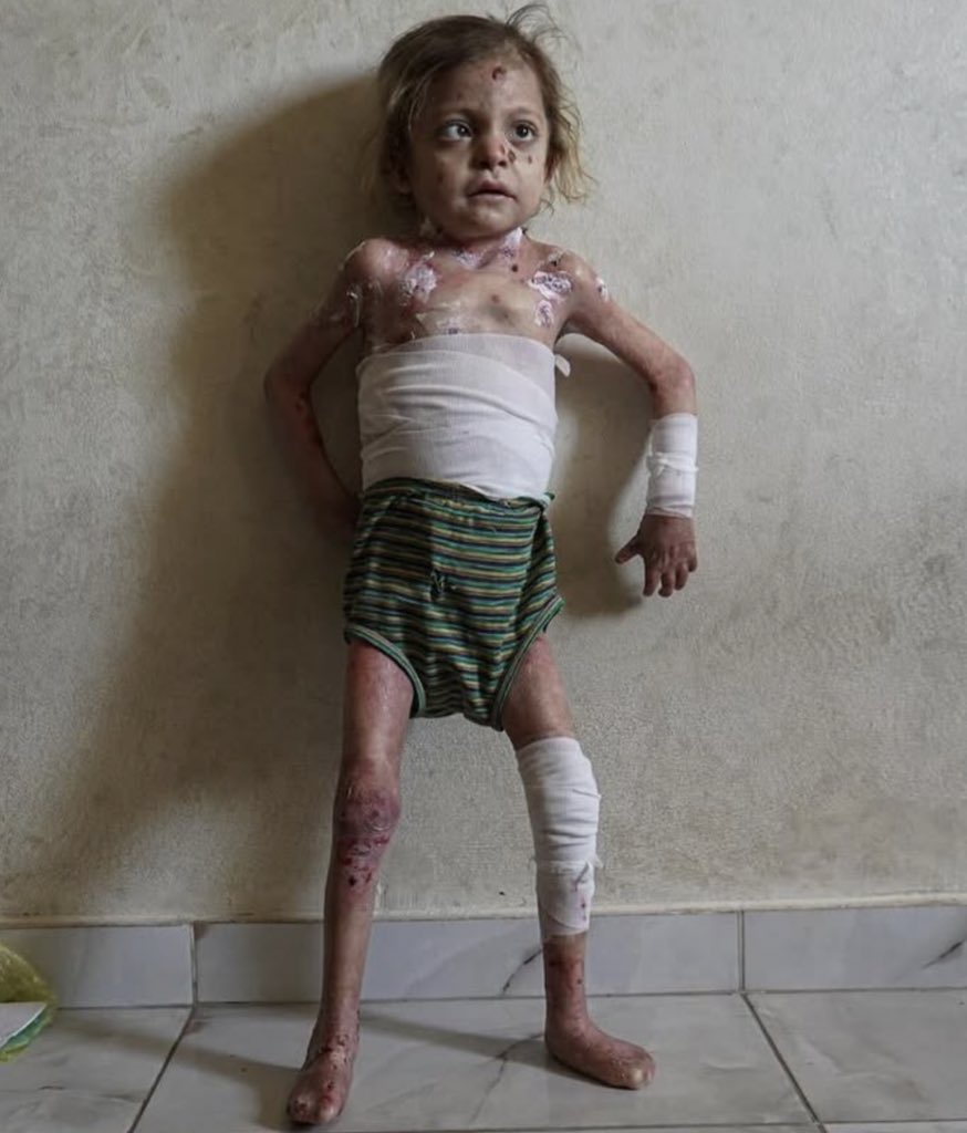 Look at this little angel girl, she is starving.
If you see this pic, reply with 💔🇵🇸