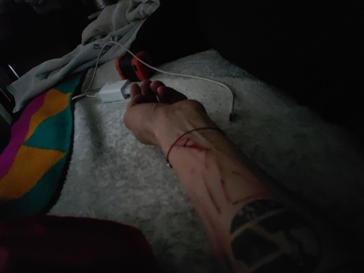 No más heridas, por fin a descansar.