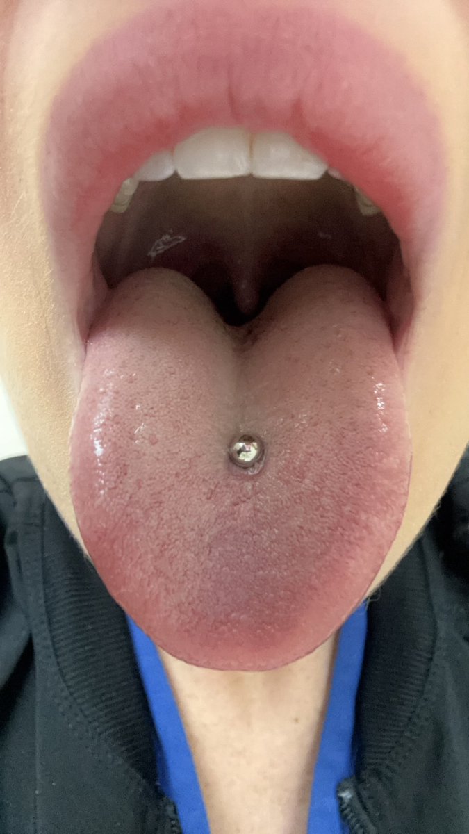 Soooo sorry you caught the shrinking virus 🦠 Gosh it’s really so sad that there’s no cure… 

We did everything we could but there’s just no making you human again ⚕️🩺

#sizetwitter #vore #mouth #shrunken