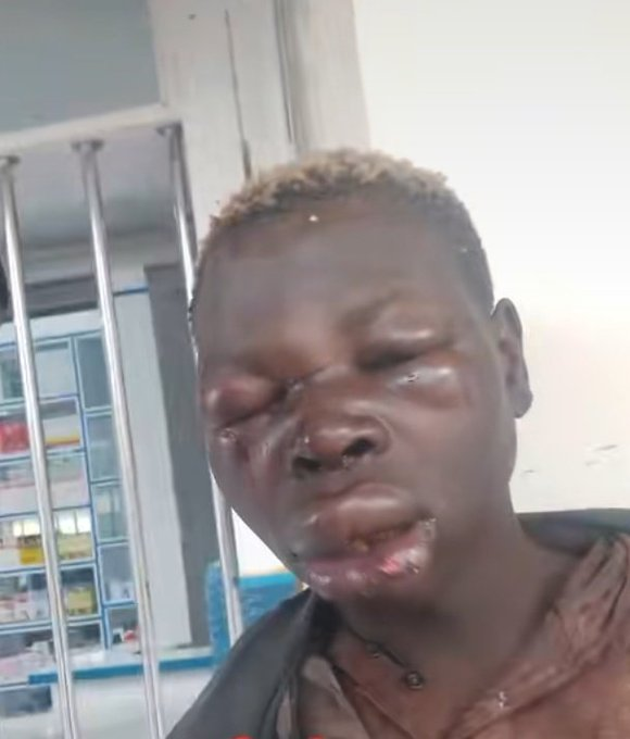 yani wanaume mnapaka make up siku hizi😂🚮