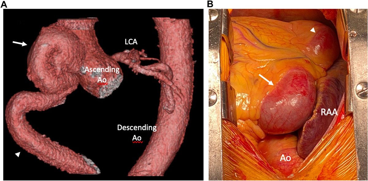 JACC Journals tweet media