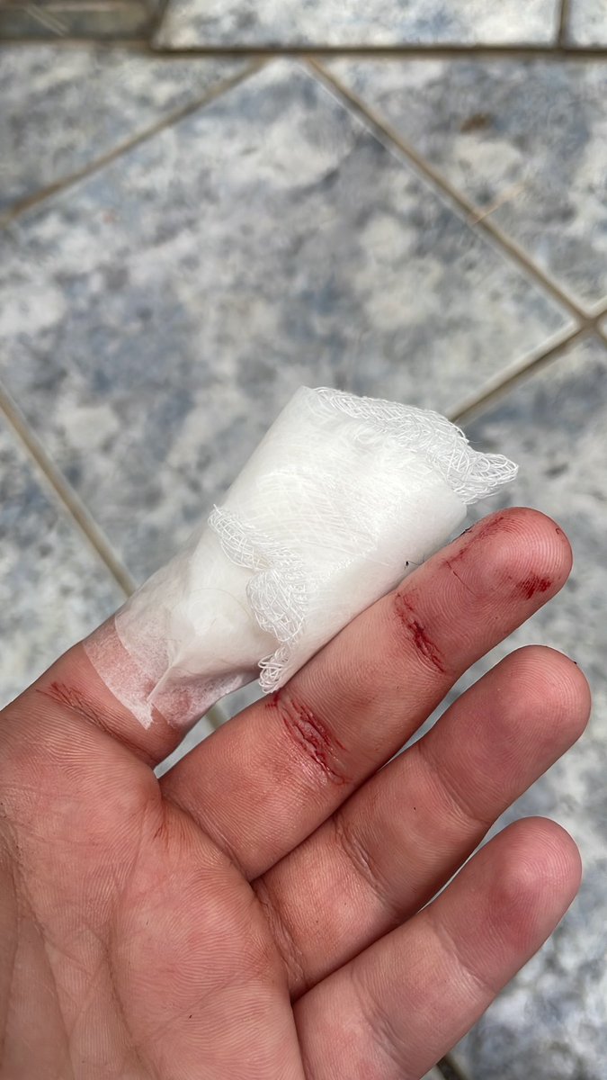 dutrinh44's tweet photo. tranquila em casa depois de quase perder o dedo e não querer dar ponto pq sou cagona https://t.co/zQ4oXjmNfd