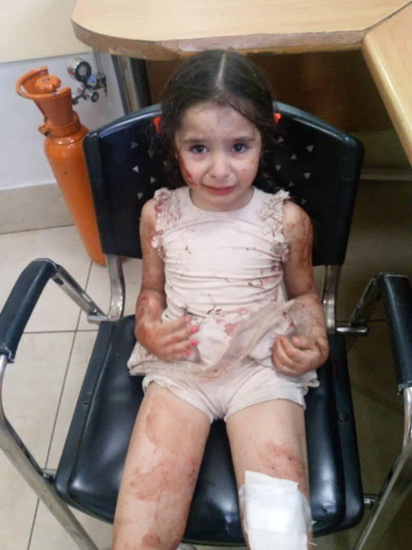 Syria: This Christian child was at the St. Elias Church in Damascus when an Islamist attacked.

Injured, shocked and scared – the girl was alone at the hospital.

We do not know the status of her family. 

As her spiritual family – pray for this child, your niece in Christ – and
