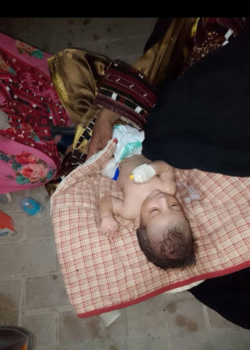 یہ حال ہے بلوچستان کے دوسرے بڑے شہر تربت کے مرکزی سول اسپتال کا جہاں بجلی نہ ہونے کے باعث مریض کھلے آسمان تلے سونے پر مجبور ہیں۔ ضلع کیچ سے 5 MPA ہیں جن میں سے 4 حکومتی بینچوں پر بیٹھے ہیں جبکہ دو ایم این اے بھی موجود ہیں۔ بلوچستان صرف سوشل میڈیا پر خوبصورت نظر آتا ہے۔