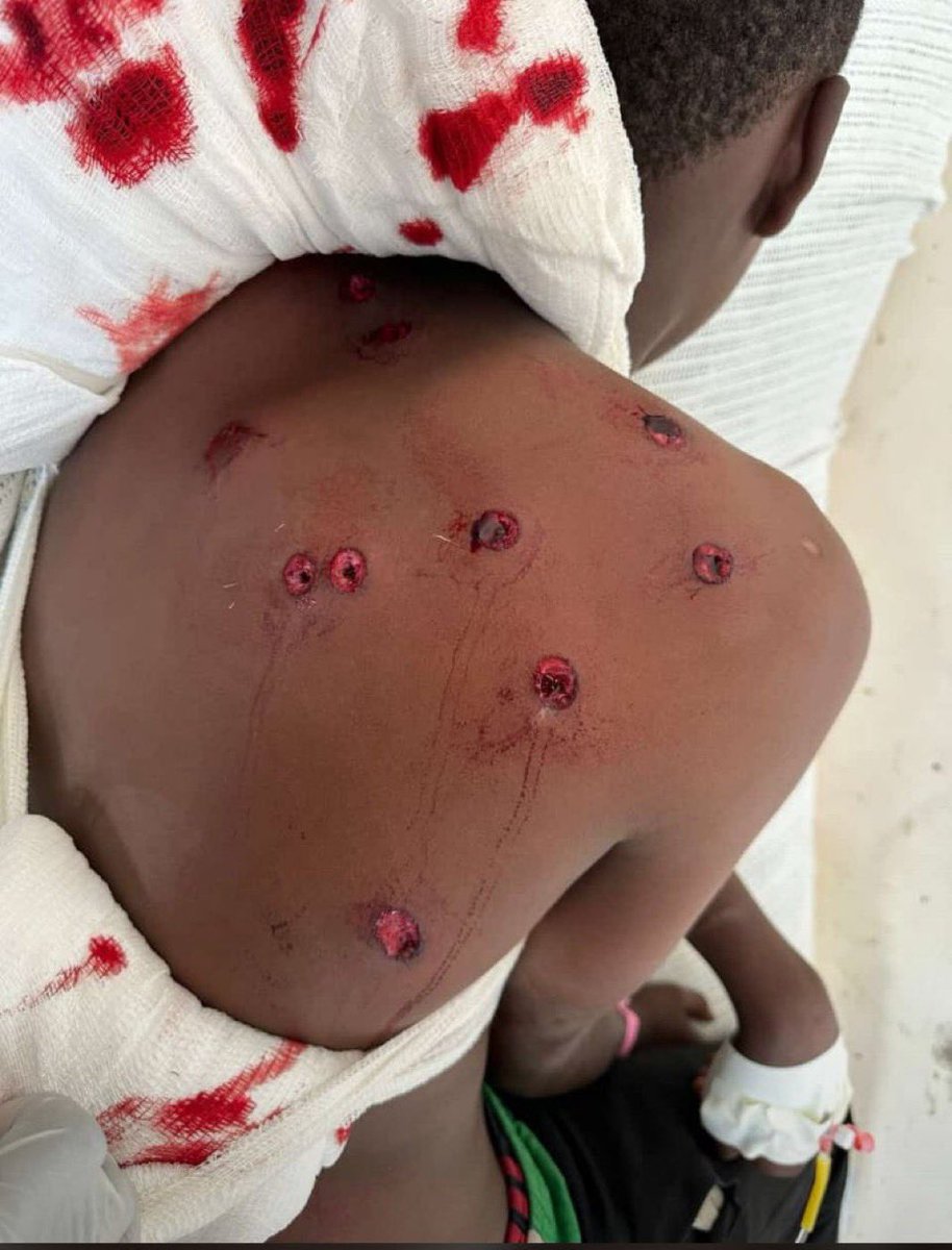 Acha tuongeze hasira

Just retweet this