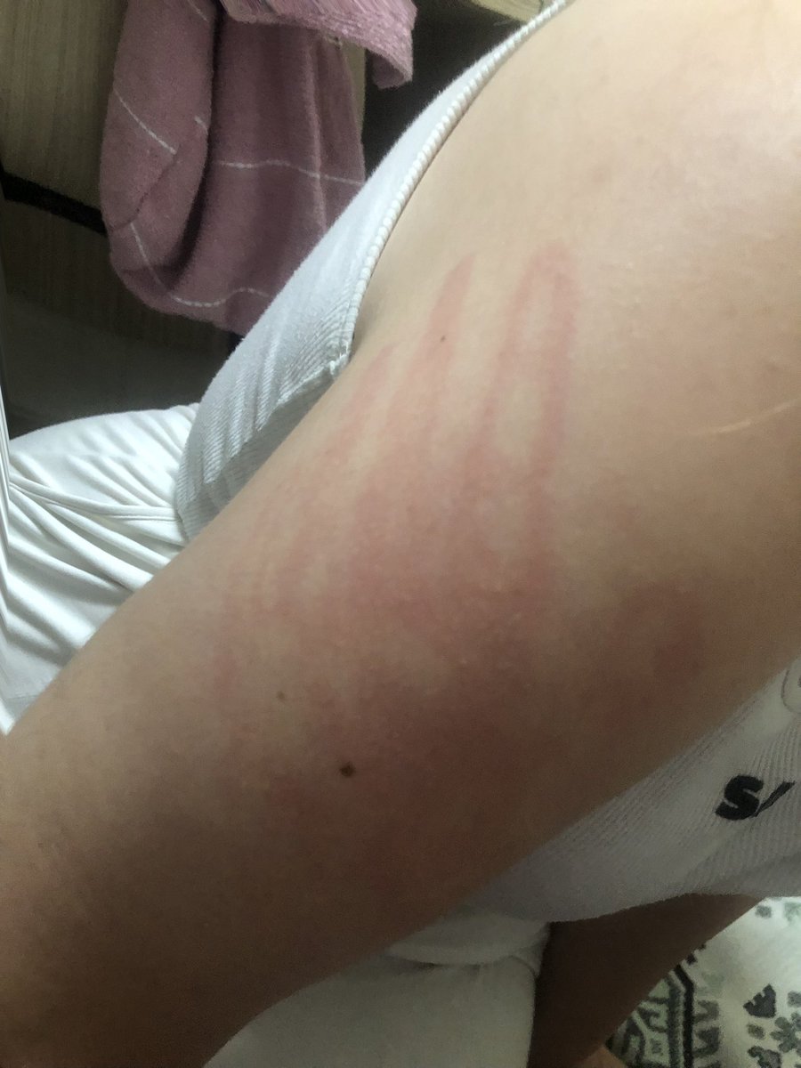 Arkadaşım şaka (kalıcı) yaptı