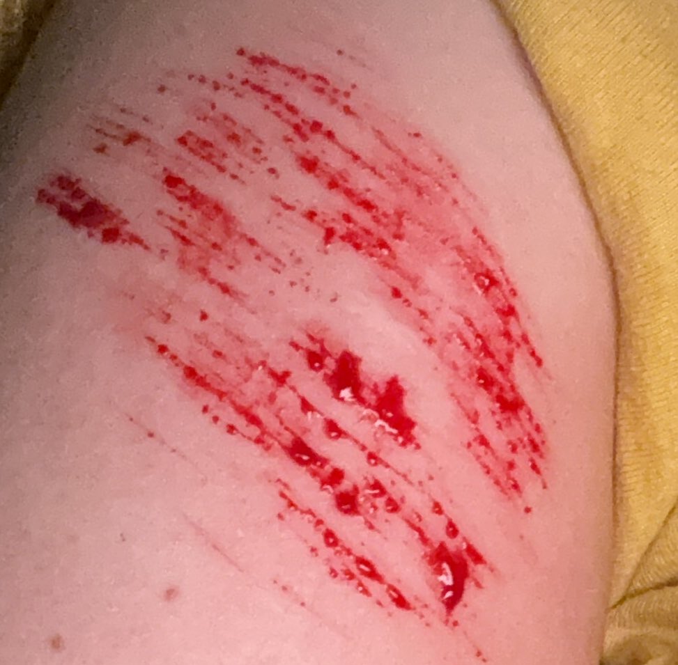 angeliccaIs's tweet photo. sh tw 
i feel so disgusting the only way i can feel clean again is if cause enough pain to my body but i can’t even do that right https://t.co/i85rbrr6rf