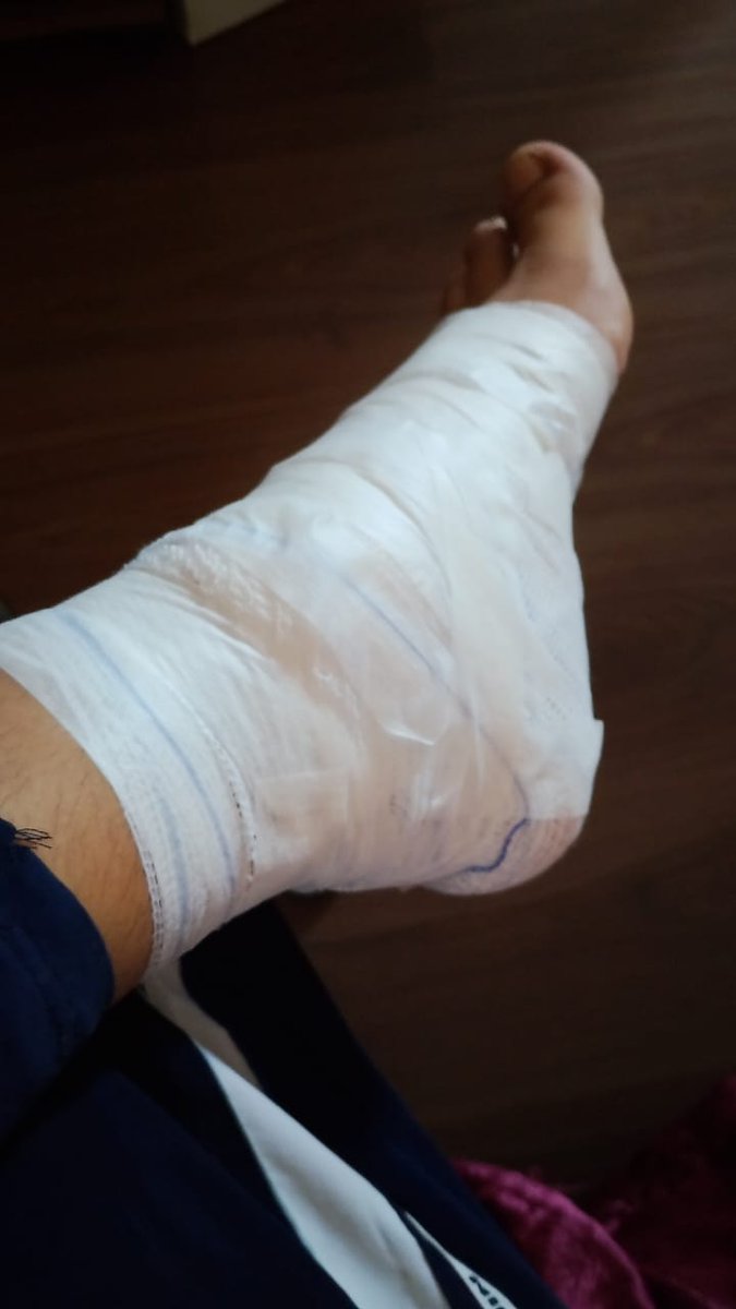 Mayachocolatech's tweet image. Meu pé morreu, mas sigo bem kkkk agora a dor já passou e tô descansando um pouco e já está melhorando bastante S2 não se preocupem só vim falar o motivo de eu estar mais presente kkkk