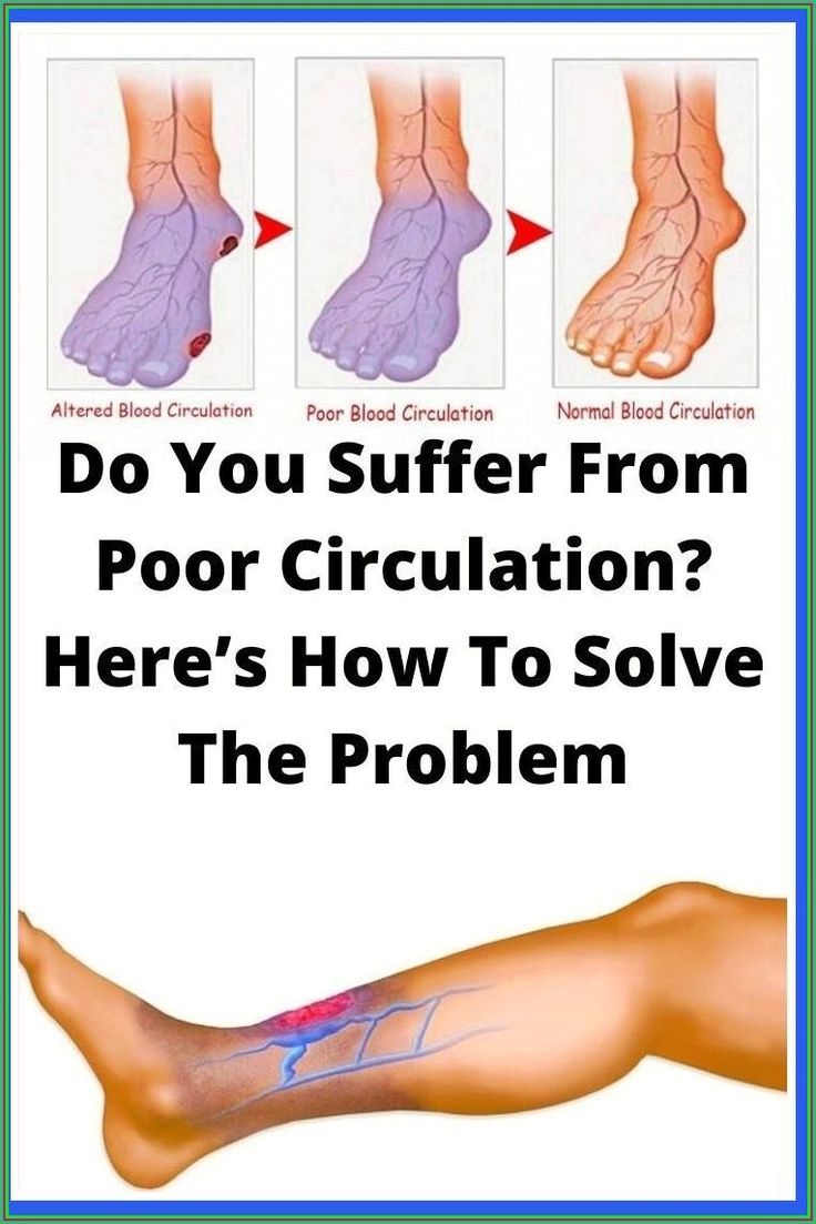 Healthy_Mgz's tweet image. Do You Suffer From Poor Circulation? Here’s How To Solve The Problem 
 
📌Read more »  healthmgz.com/2022/06/do-you…

#ImproveCirculation #HealthyBloodFlow #NaturalHealthTips #CirculationSupport #WellnessOver50 #ColdFeetFix #Remedies #DailyWellnessRoutine #HolisticLiving #HealthyHabits