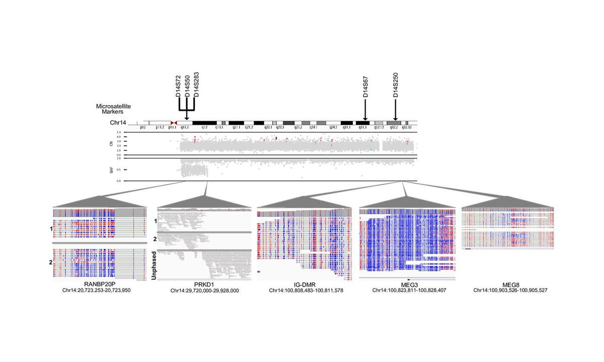 benagen3571's tweet photo. [case report] Using long-read sequencing to detect and subtype a case with Temple syndrome. #nanopore #subtype   #copy_number https://t.co/NIMA5npuNu https://t.co/NA2AWuGISS