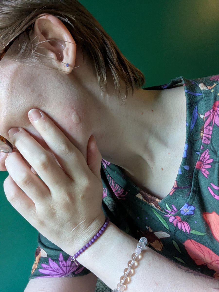 If getting bitten by mosquitos on the face was a sport, I'd excel at it to greatly😵‍💫🫩