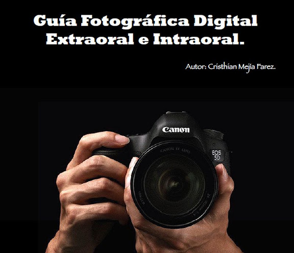 PDF odontologiavirtual.com/2016/07/pdf-gu…

Si vas a comprarte una cámara réflex debes leer esto. Me gustaría que la compraras, porque esta guía está dedicada al uso de las cámara réflex para el uso de fotografía clínica odontológica.

Las cámaras réflex son de gran utilidad en el área de la