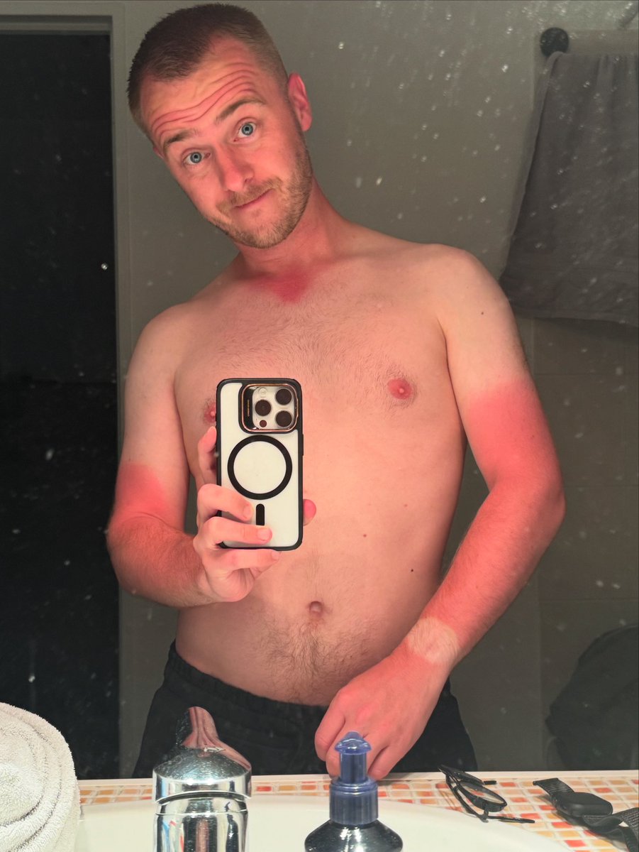 Fabien__2__3's tweet photo. Quand tu voulais juste bronzer… et que tu termines en glace vanille / fraise 🍓🍦😅
Le Soleil 1 – Moi 0 ☀️🔥 https://t.co/iFT9tuvzcy
