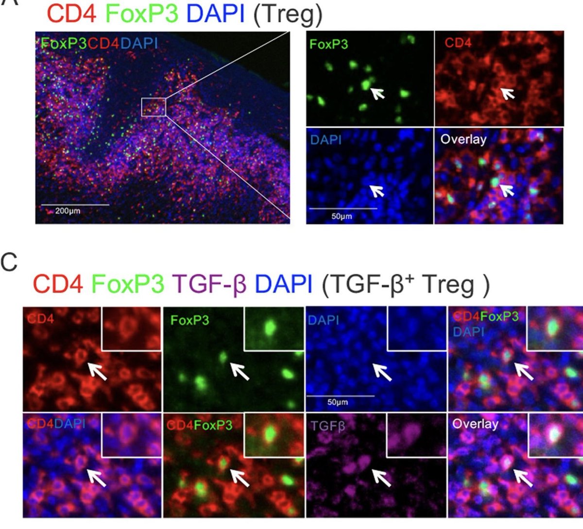 MucosalImmunol's tweet image. Even when present, Tregs can be unresponsive and display reduced immunosuppressive function during extensive microbial dysbiosis: mucosalimmunology.org/article/S1933-…
