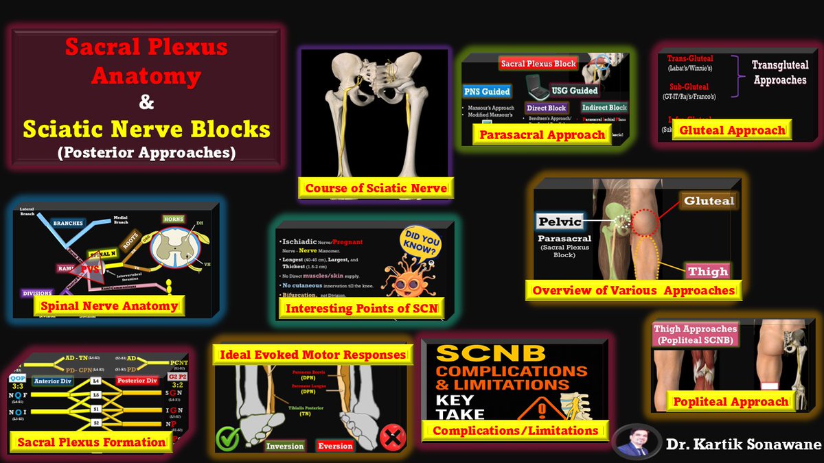 KartikBSonawane's tweet photo. 🧠 "Click. Learn. Block Like a Pro!"

#RegionalAnesthesia #SciaticBlock #SacralPlexus #EDRA #UltrasoundBlocks
#MyVideos

Get my 10-video Sciatic Nerve Block Series in one clickable PDF 🎥

From Spinal Nerve Roots ➡️ Popliteal Precision, it's all covered:

📌 Spinal & Sacral Plexus Anatomy
📌 Sciatic Course & Injection Landmarks
📌 Parasacral | Gluteal | Popliteal Approaches
📌 Ideal LA Deposition
📌 Complications & Safety Pearls

📄 Download the clickable index:
🔗 https://t.co/iqpTh6iygd