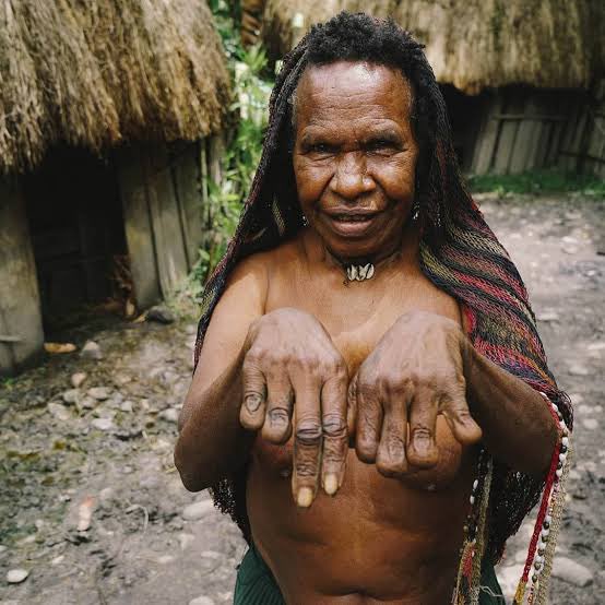 1. In Papua New Guinea, when someone dies, family members cut off their own fingers as a sign of mourning.