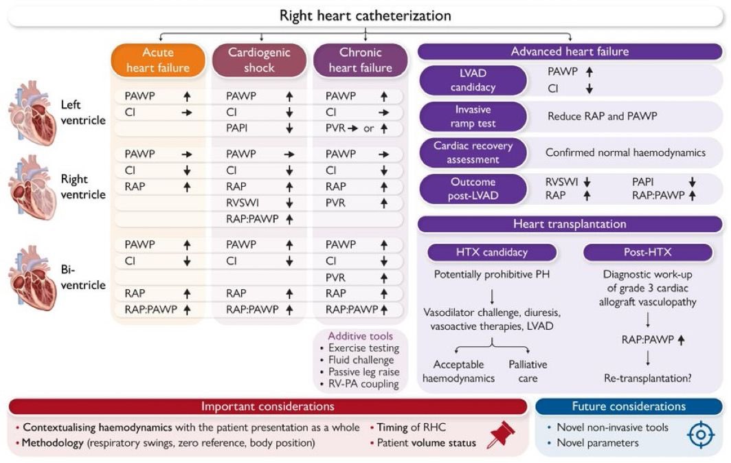Right heart catheterization in heart failure: indications, interpretation, and pitfalls

RHC plays a pivotal role across the spectrum of heart failure, from ambulatory patients to those in cardiogenic shock or under consideration for LVAD therapy and HS

academic.oup.com/eurheartj/adva…