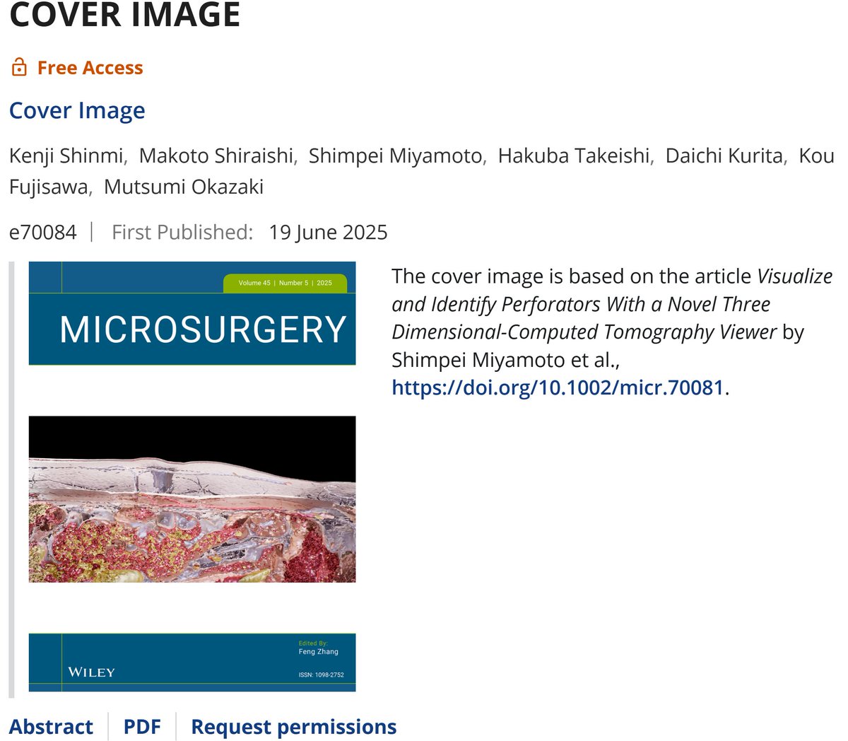 viewtify's tweet photo. The first short report featuring Viewtify in the field of plastic surgery has just been published in Microsurgery! It highlights the usefulness of visualizing perforators in DIEP flap planning — and the figure was selected for the journal cover! https://t.co/ifIUfBWmfx