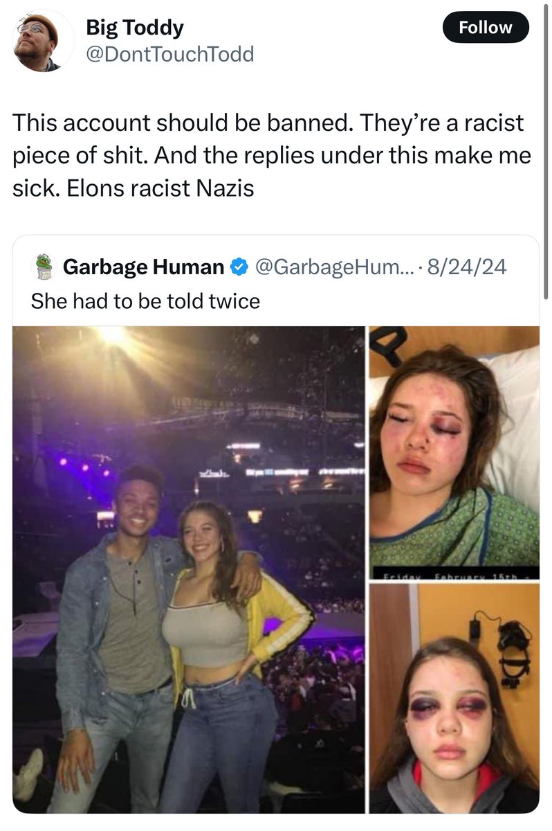 Garbage Human tweet media
