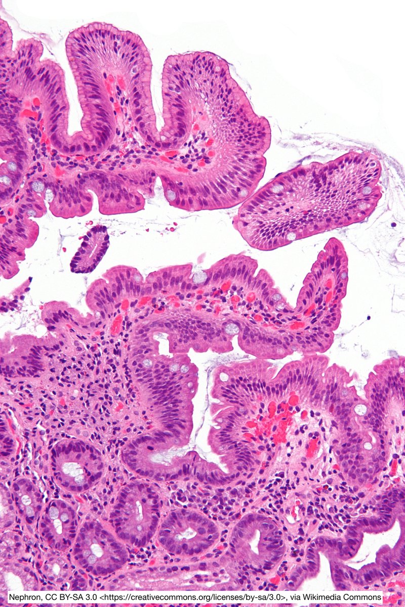 Jay "Thymocyte" Hwang tweet media