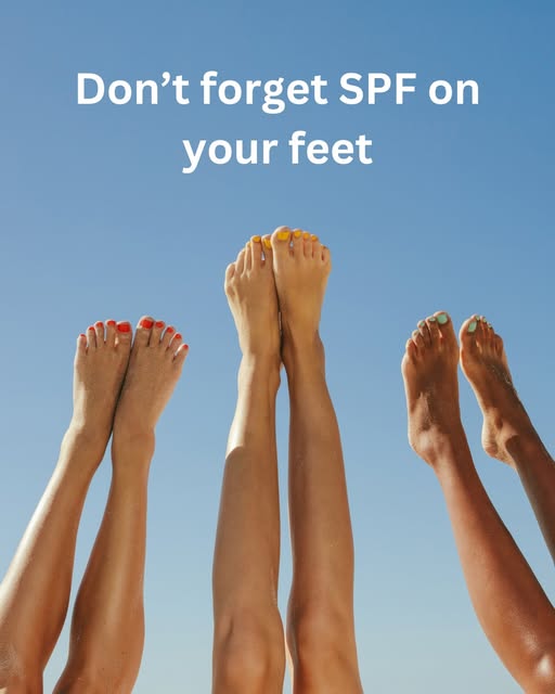 GillianAMichael's tweet photo. Many don’t realise skin cancer can occur on the feet from unprotected sun exposure so don't overlook applying sunscreen to your feet.

#footcancer #cancerawareness #feethealth https://t.co/gjghNNanop
