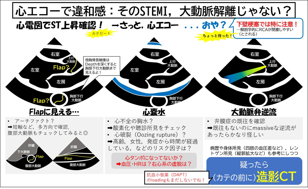Dr_ppooohh's tweet photo. そうなんですよね！

以前に衝動的に作ったこのスライドでも、シェーマ内の心嚢水は大動脈の上にしてます！
つまりそーゆーこと！ https://t.co/FUKeZUNCbo