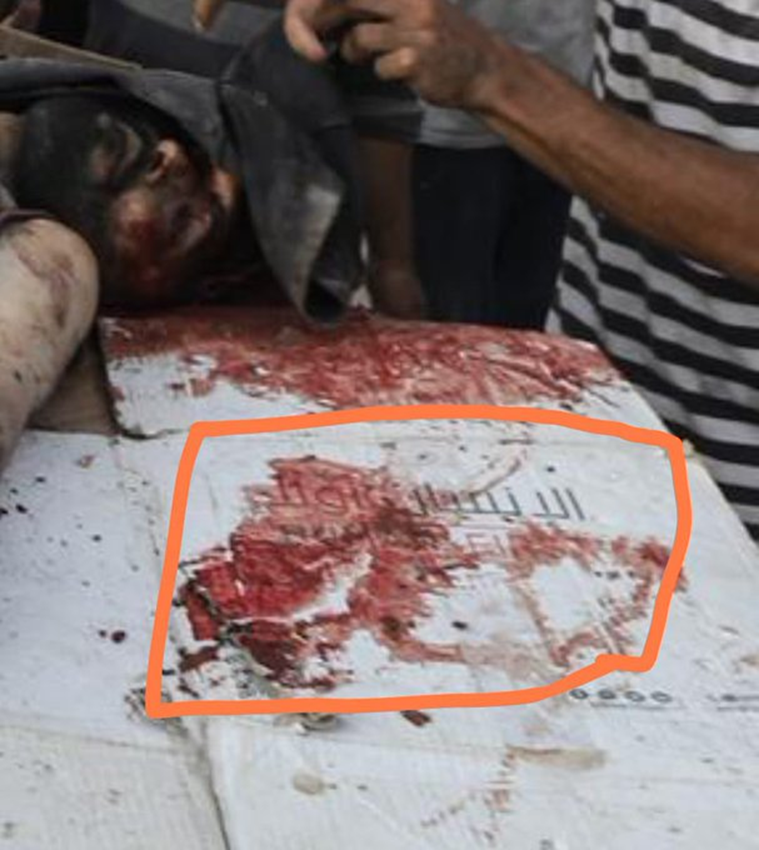 Dr_EyadQun's tweet image. لا تَدَعوا الأحداث تشغلكم عما يحدث بإخوانكم في غزة وفلسطين. في غزة: استمرار #مجازر_المساعدات_الأمريكية
ومن آخرها هذا الأخ الذي التصق جلده بعظمه من الجوع، ذهب يأخذ "المساعدات" وهو يعلم أنها مصيدة، لكن ماذا يفعل؟ لا بد من أن يحاول..
فكانت النتيجة أن تردى قتيلاً -تقبله الله في…