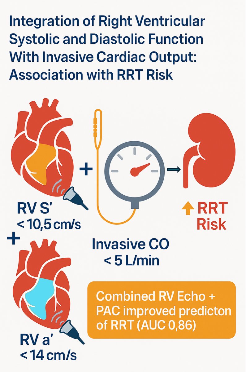 Our latest article: RV dysfunction predicts need for RRT in AMI-related cardiogenic shock

RV S’ &lt;10.5 cm/s (↓ systolic), RV a’ &lt;14 cm/s (↓ compliance), and CO &lt;5 L/min all associated with RRT.
🔹RV S’ had highest AUC (0.80)
🔹Echo + PAC improved prediction (AUC 0.86)
(1/2)