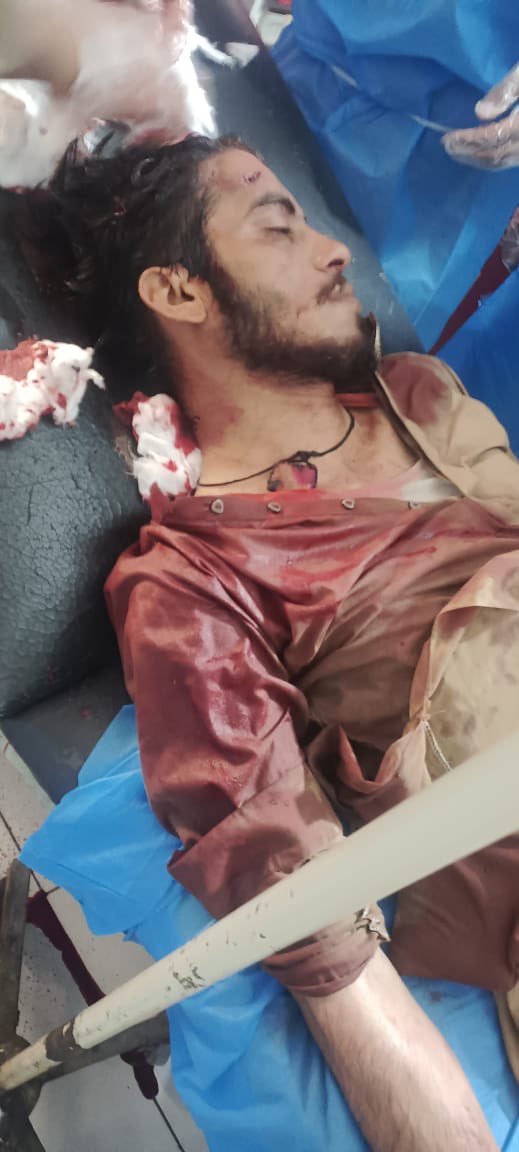 Asad Baloch (@asad_abul89) on Twitter photo Adeel son of Master Iqbal, a resident of Apsar area of Turbat, was shot dead by unknown assailants in front of Park Hotel today. Adeel had recently been rescued after being forcibly disappeared.
#EndEnforcedDisappearances
#StopBalochGenocide
<a href="/WGEID/">UN Working Group on Enforced Disappearances</a> <a href="/DutchMFA/">Dutch Ministry of Foreign Affairs 🇳🇱</a> <a href="/DutchNewsNL/">DutchNews.NL</a> Adeel son of Master Iqbal, a resident of Apsar area of Turbat, was shot dead by unknown assailants in front of Park Hotel today. Adeel had recently been rescued after being forcibly disappeared.
#EndEnforcedDisappearances
#StopBalochGenocide
<a href="/WGEID/">UN Working Group on Enforced Disappearances</a> <a href="/DutchMFA/">Dutch Ministry of Foreign Affairs 🇳🇱</a> <a href="/DutchNewsNL/">DutchNews.NL</a>