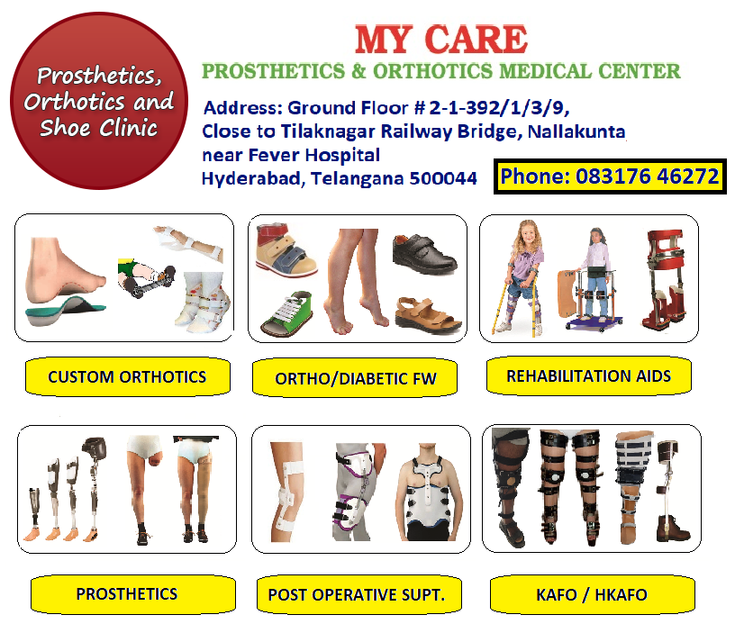 mycaremedical's tweet photo. My care prosthetics  and orthotics
shoe  clinic
orthotics centre
prosthetics fitment
Rehabilitation aids services

#mycaremedical #prosthetics #orthotics #medicalcentre #nearme #orthopedicbraces #splints https://t.co/7OG8WlzR8A