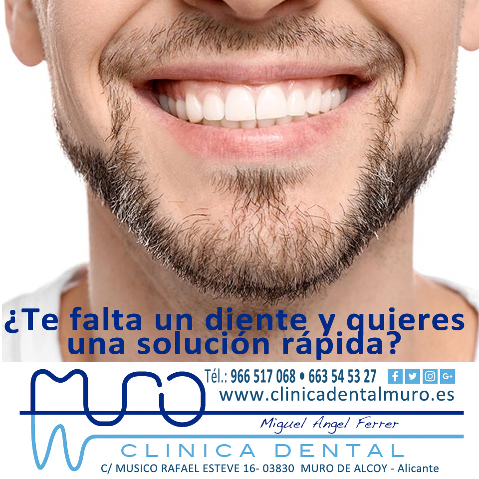 DentalMuro's tweet image. Implantes en un solo día
¿Te falta un diente y quieres una solución rápida? Con la técnica de implantes inmediatos, en Clínica Dental Muro colocamos el implante y la corona provisional en una sola sesión.
Pide cita en 966 51 70 68
#ImplantesExpres #RecuperaTuSonrisa  #MuroDeAlcoy