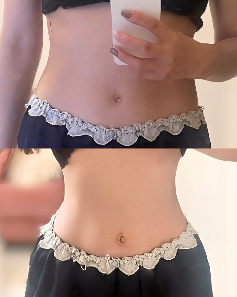 骨格ウェーブのダイエット事情⬇️
たった7kgの差なのに特化薬使っただけですんごい変化、、(笑)脚痩せた代わりに上半身ｶﾘｶﾘだけど今の自分が人生で1番細くてスキ💖❕