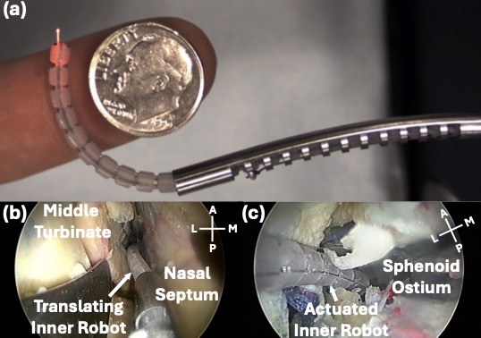 Kent Yamamoto (@kentkyamamoto) on Twitter photo 🤖 New Paper alert! 🧠
"Tendon-Actuated Concentric Tube Endonasal Robot (TACTER)" with <a href="/TannerZachem/">Tanner Zachem</a> available via JMRR!
- 🐍 New robot for endoscopic endonasal approaches!
-〰️Nonlinear trajectories!
- 🧠Cadaver trials!
<a href="/DukeEngineering/">Duke Engineering</a> <a href="/DukeMedSchool/">Duke University School of Medicine</a> <a href="/Dukeneurosurg/">Duke Neurosurgery</a> 🤖 New Paper alert! 🧠
"Tendon-Actuated Concentric Tube Endonasal Robot (TACTER)" with <a href="/TannerZachem/">Tanner Zachem</a> available via JMRR!
- 🐍 New robot for endoscopic endonasal approaches!
-〰️Nonlinear trajectories!
- 🧠Cadaver trials!
<a href="/DukeEngineering/">Duke Engineering</a> <a href="/DukeMedSchool/">Duke University School of Medicine</a> <a href="/Dukeneurosurg/">Duke Neurosurgery</a>