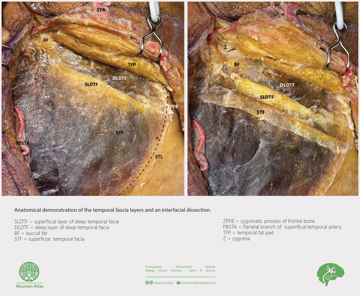 Neuroan Atlas tweet media