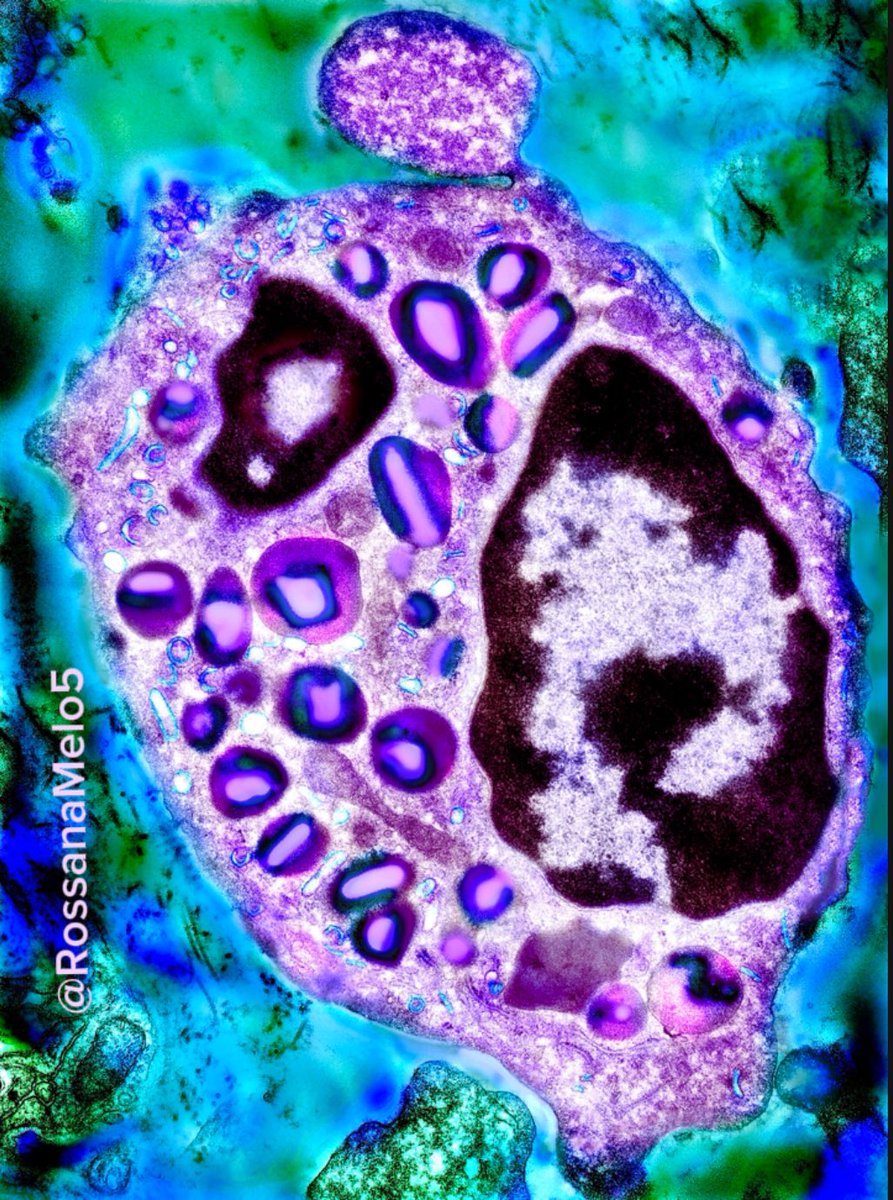Rossana Melo (@rossanamelo5) on Twitter photo Excited to bring my #sciart exhibition to the <a href="/EosinophilSoc/">International Eosinophil Society</a> Congress in Montpellier, July 7-11! 🤩 Here's a sneak peek at one of the pieces! Can't wait to be part of such an inspiring gathering!
#MicroscopyMonday #science #eosinophils #ElectronMicroscopy Excited to bring my #sciart exhibition to the <a href="/EosinophilSoc/">International Eosinophil Society</a> Congress in Montpellier, July 7-11! 🤩 Here's a sneak peek at one of the pieces! Can't wait to be part of such an inspiring gathering!
#MicroscopyMonday #science #eosinophils #ElectronMicroscopy