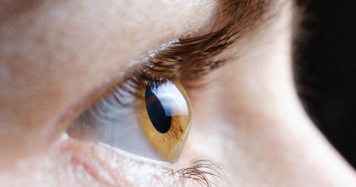 Ophthalmology Mgmt (@ophthalmologymg) on Twitter photo In recent years, numerous advancements in keratoconus management have developed to significantly improve the quality of life for patients with the disease. <a href="/KenBeckmanMD/">Kenneth Beckman, MD</a> discusses some of those advancements: ophthalmologymanagement.com/issues/2025/ju⊠<a href="/GlaukosCorp/">GlaukosCorp</a> #keratoconus #cornea #corneal In recent years, numerous advancements in keratoconus management have developed to significantly improve the quality of life for patients with the disease. <a href="/KenBeckmanMD/">Kenneth Beckman, MD</a> discusses some of those advancements: ophthalmologymanagement.com/issues/2025/ju⊠<a href="/GlaukosCorp/">GlaukosCorp</a> #keratoconus #cornea #corneal