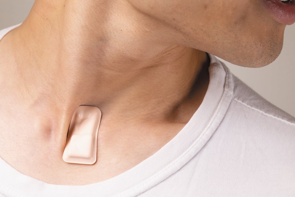 🛌 A new wearable from <a href="/ProfJohnARogers/">John A Rogers</a>’ team <a href="/NorthwesternU/">Northwestern</a> may improve sleep disorder detection by capturing mechano-acoustic signals from the suprasternal notch.

Thanks <a href="/MelissaLRohman/">Melissa Rohman</a> (<a href="/NUFeinbergMed/">Northwestern Feinberg School of Medicine</a>) for the coverage — and kudos to <a href="/yayun_du/">Vanderbilt_YayunDu</a> (former <a href="/NU_QSIB/">Querrey Simpson Institute for Bioelectronics</a>, now