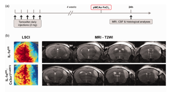 _JCBFM's tweet image. 🚨 New #HotTopic in stroke research:
Could microglial IL-1α be the next-gen stroke therapy?
🧠 Selective IL-1α deletion shows it’s not key in acute injury, but crucial for long-term recovery post-stroke.
🔗 Read the study: journals.sagepub.com/doi/full/10.11…