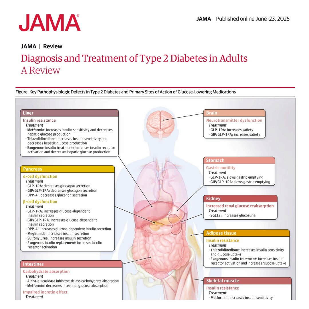 JAMA (@jama_current) on Twitter photo Type 2 diabetes affects up to 14% of the global population.
This Review discusses the diagnosis, treatment, and prognosis of adults with type 2 diabetes.
#ADASCiSessions <a href="/ADA_DiabetesPro/">American Diabetes Association - DiabetesPro</a>
ja.ma/4l3AyHd Type 2 diabetes affects up to 14% of the global population.
This Review discusses the diagnosis, treatment, and prognosis of adults with type 2 diabetes.
#ADASCiSessions <a href="/ADA_DiabetesPro/">American Diabetes Association - DiabetesPro</a>
ja.ma/4l3AyHd