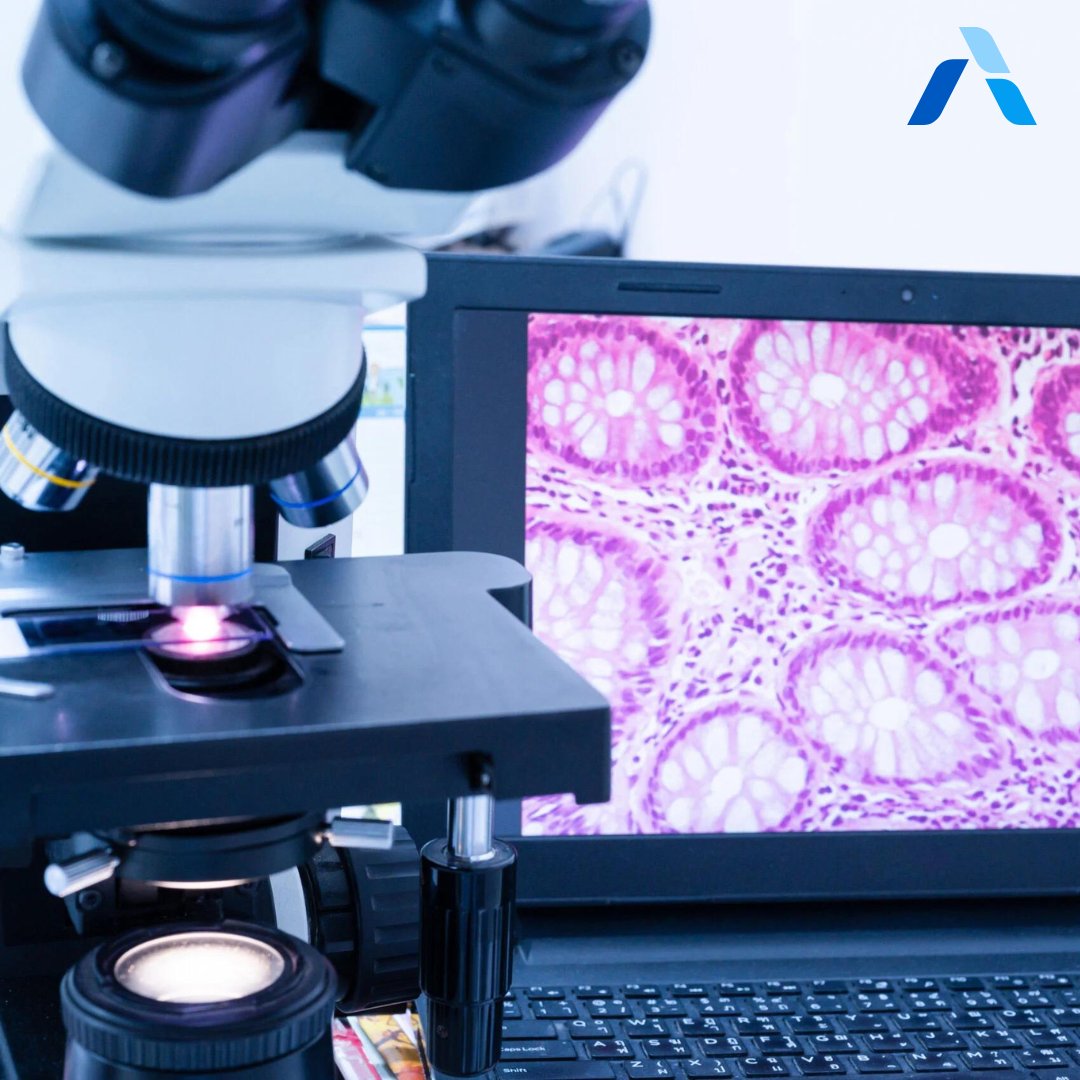 arteraAI's tweet image. Did you know: The ArteraAI Prostate Test provides therapy-relevant insights across the spectrum of localized prostate cancer—guiding decisions from active surveillance to short-term ADT to adjunctive abiraterone therapy.
Learn more: artera.ai