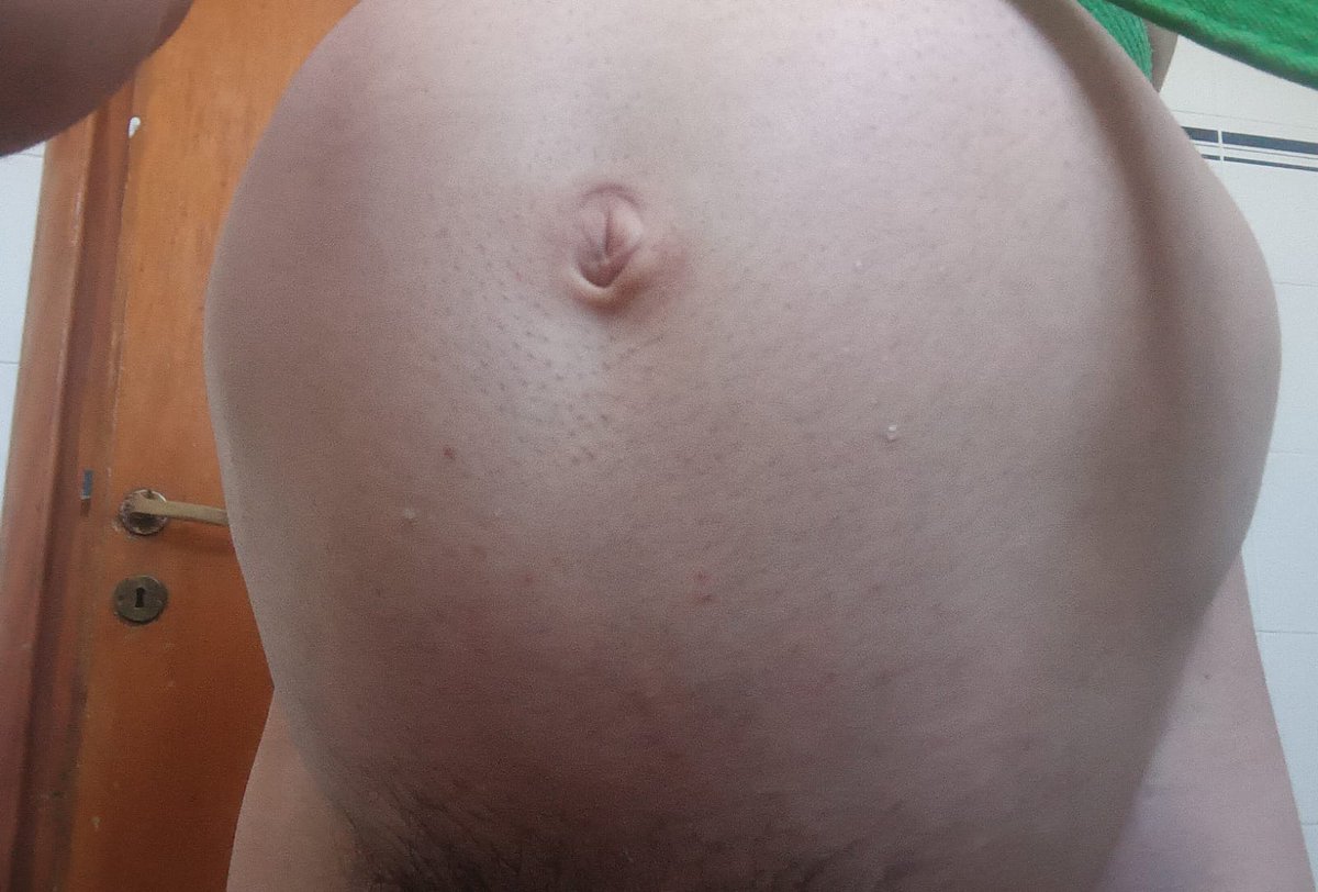 pregnant water belly 
I warn you that in the first photo I deflated quite a bit, in the second one that I took from the front I was at my maximum, it hurt a lot and I felt the skin stretched from the pain haha