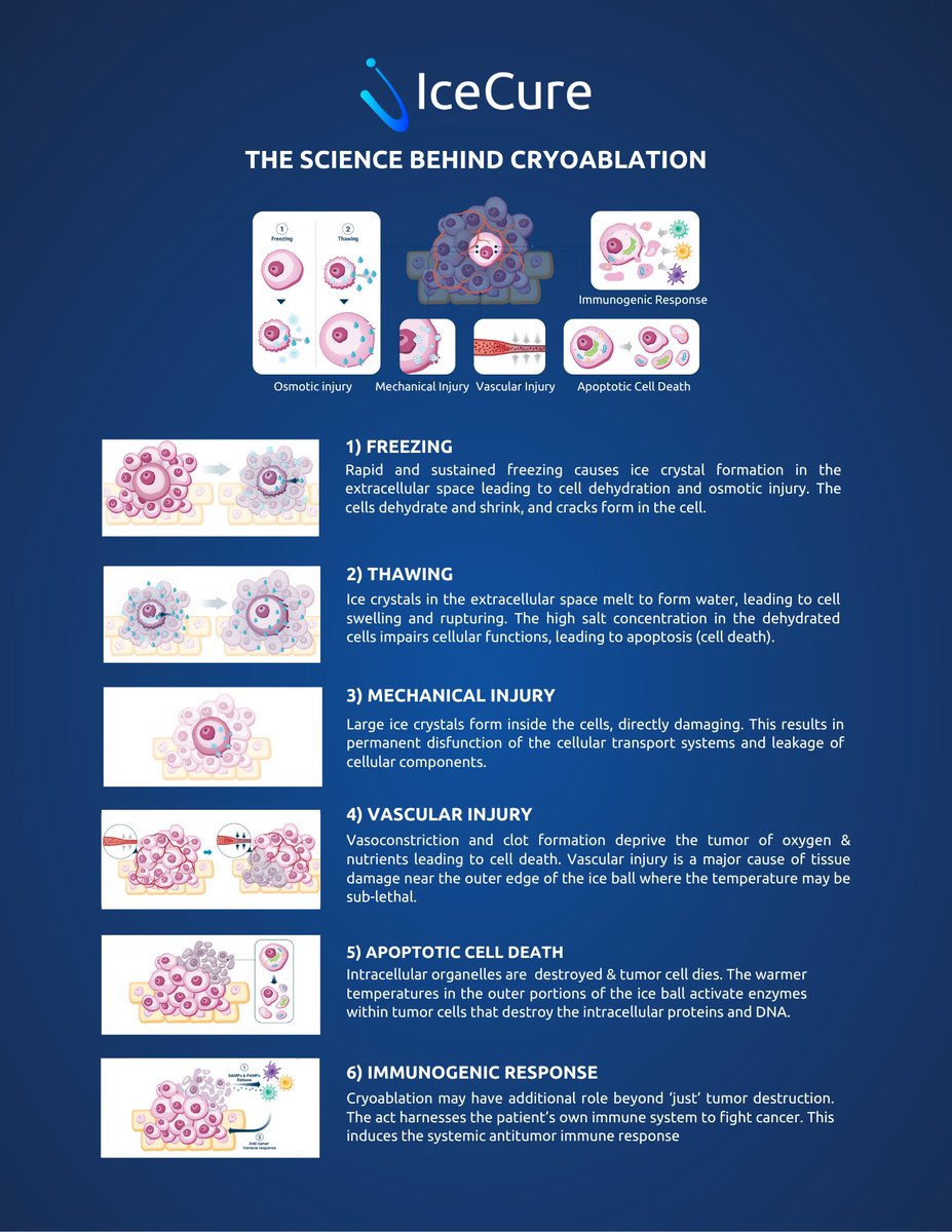 Curious how cryoablation uses extreme cold to destroy tumors?❄️❄️

Check out our infographic and blog on the science behind IceCure’s liquid nitrogen based cryoablation technology:

 🔗icecure-medical.com/blog/cryoablat…