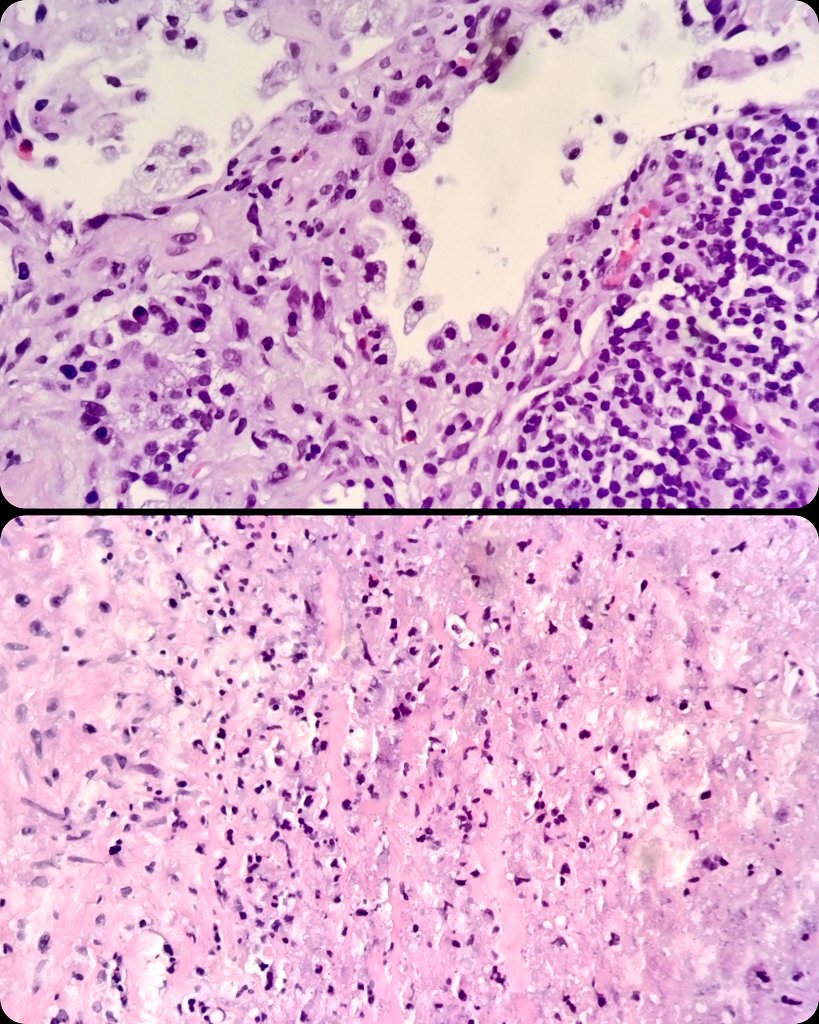 Héctor-Enrique Torres-Rivas, MD, MIAC tweet media