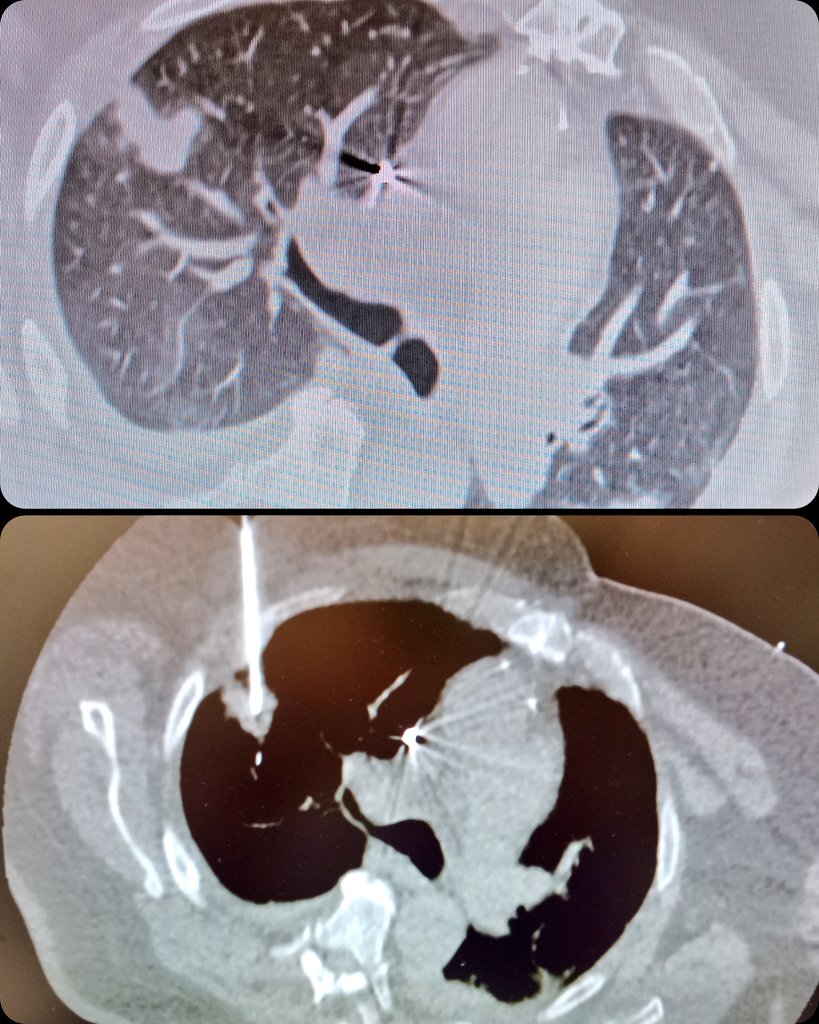 Héctor-Enrique Torres-Rivas, MD, MIAC tweet media