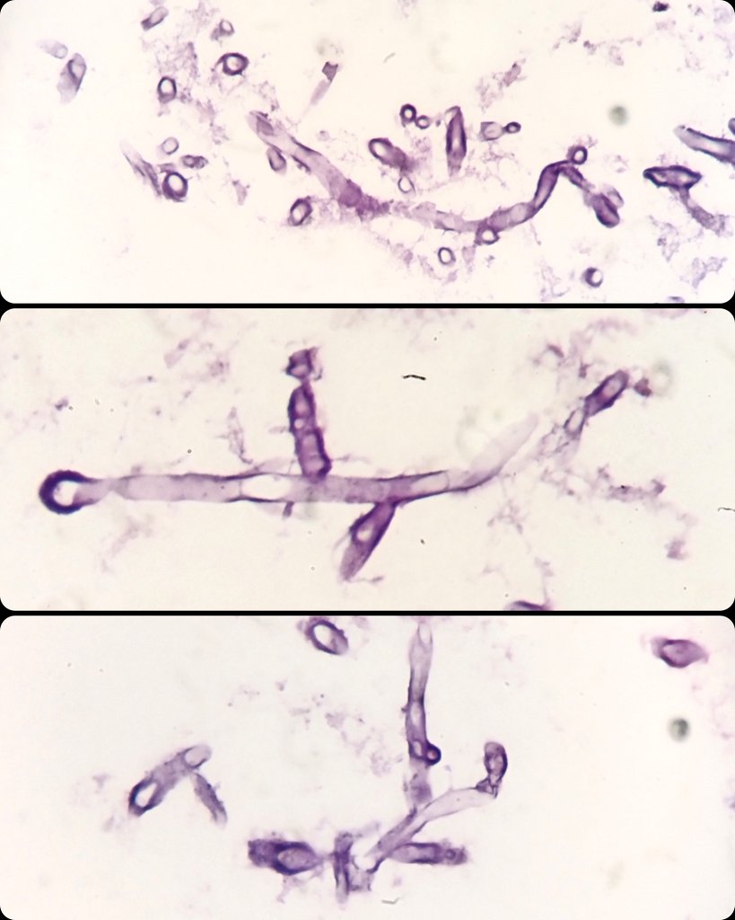 Héctor-Enrique Torres-Rivas, MD, MIAC tweet media